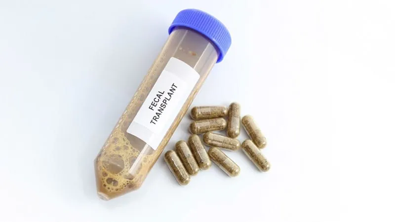Fecal microbiota transplants don't move the needle for IBS, meta-analysis finds