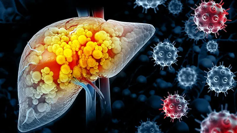 AI model outperforms traditional tools in predicting liver cancer risk in young adults
