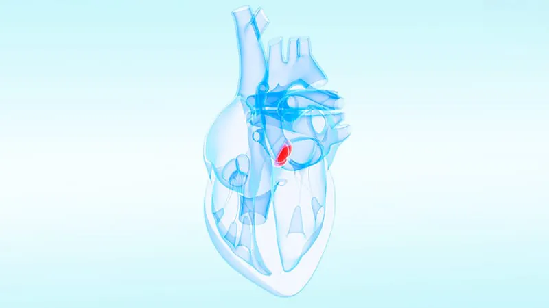 The Ross procedure is rewriting the rulebook on aortic valve replacement