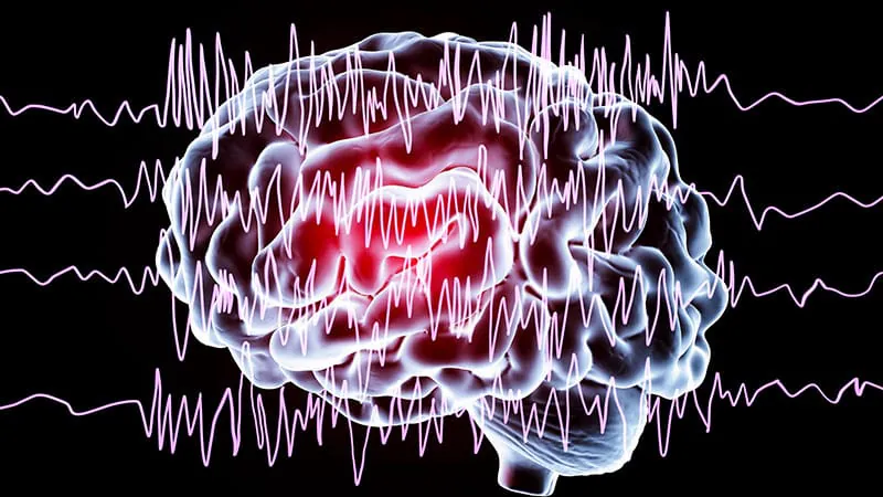Most epilepsy relapses are preventable — not drug-resistant