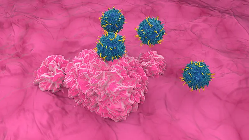 CAR T-cell therapy is on the verge of its first autoimmune disease approval