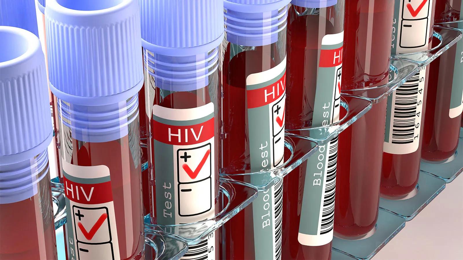 Ending HIV isn't about new drugs — it's about fixing the system