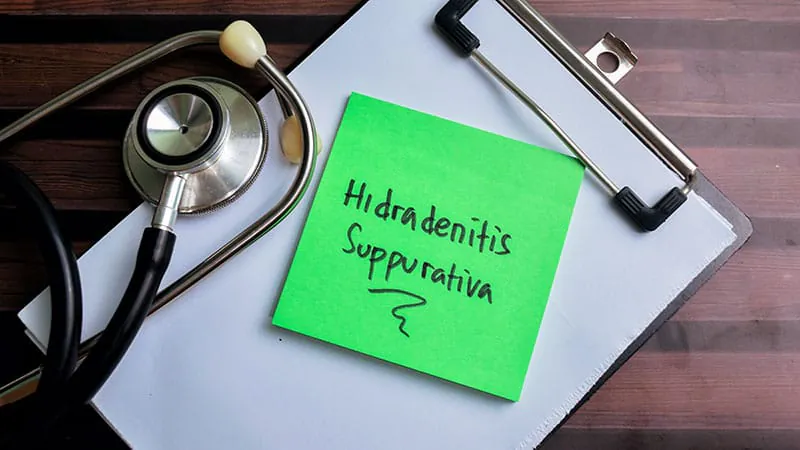 Surgery is making a comeback for hidradenitis suppurativa — and it can be done in the office