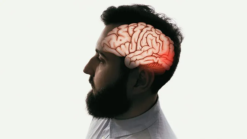 The obesity-headache connection your patients need to know about