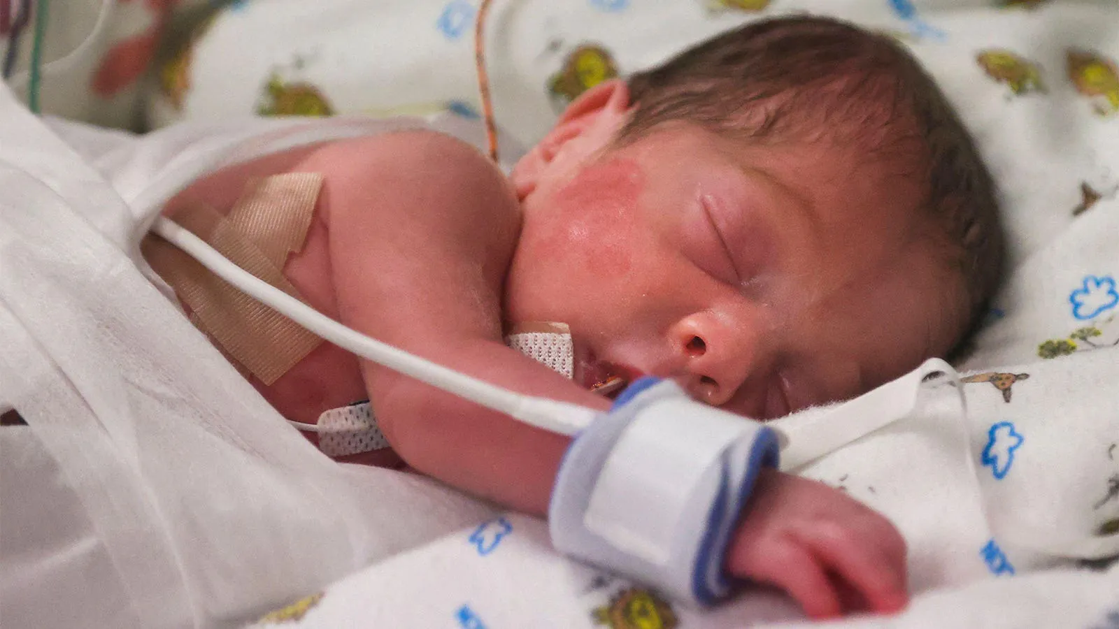 Infant formula makers face scrutiny over unreported NEC deaths in preterm babies