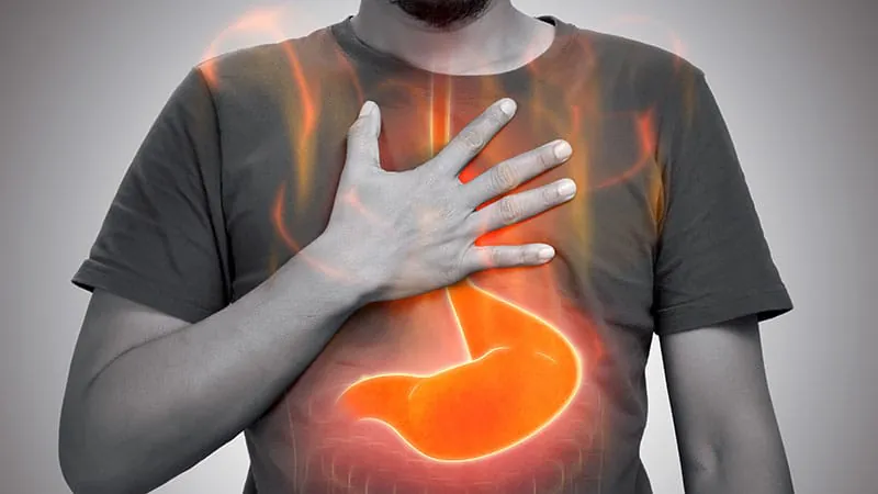 Sleeve gastrectomy with hiatal hernia repair shows solid long-term results — but reflux is a red flag