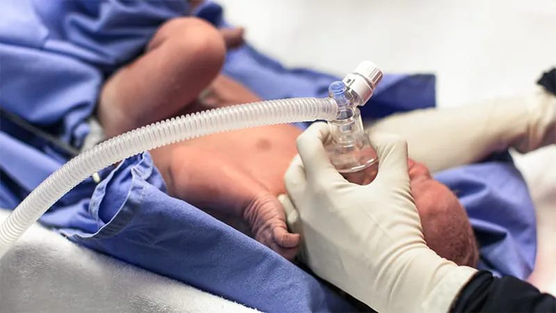 Higher breathing pressure at birth may protect premature babies from serious complications