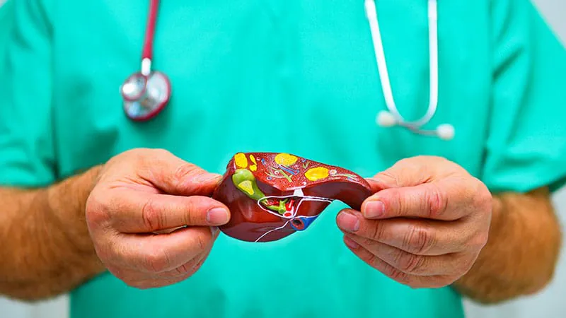 Fatty liver disease is surprisingly common in young women with PMOS — and current screening tools are missing it