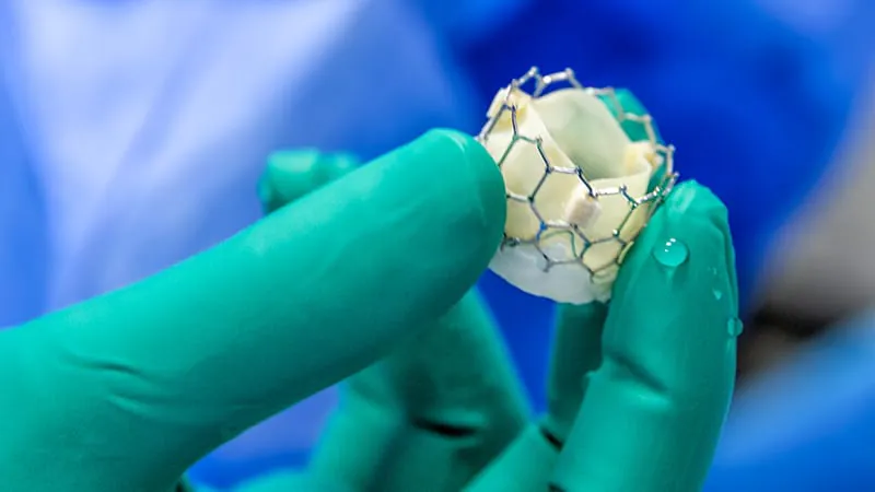TAVR holds its own against surgery at 7 years — but experts want more time