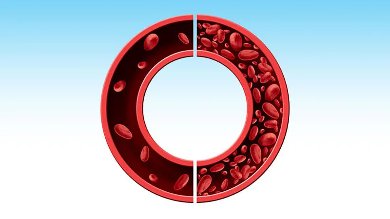 From death sentence to manageable condition: The remarkable story of pernicious anemia
