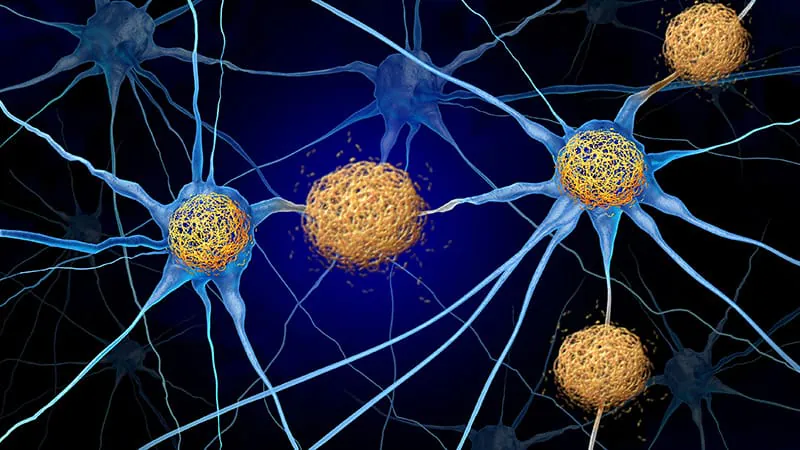 Are Alzheimer's drugs actually working? Experts can't agree