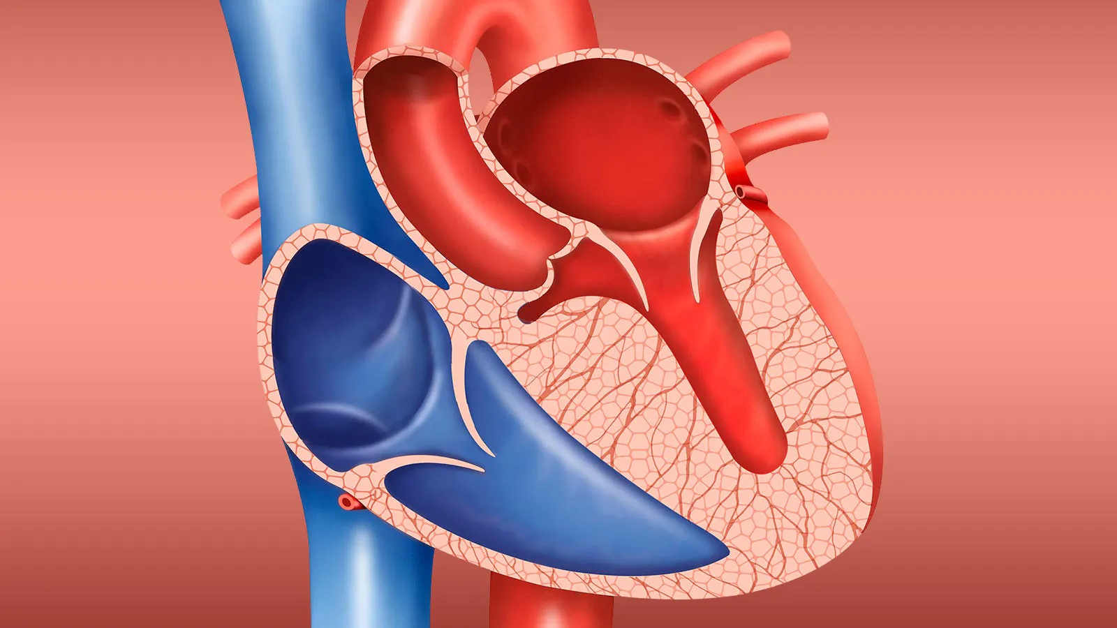 Predicting who with mild HCM is headed for trouble