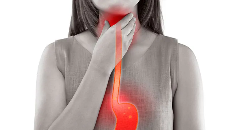 Silent GERD in obesity: A diagnostic tool catching what symptoms miss