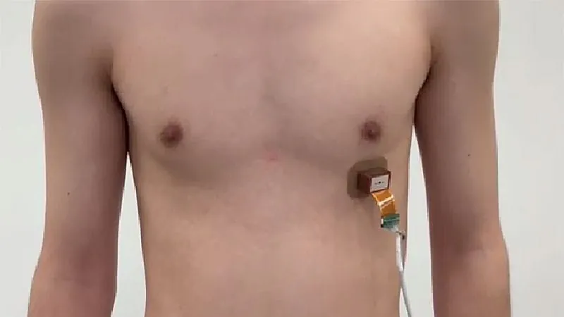 MIT's wearable ultrasound pacemaker could make implants a thing of the past