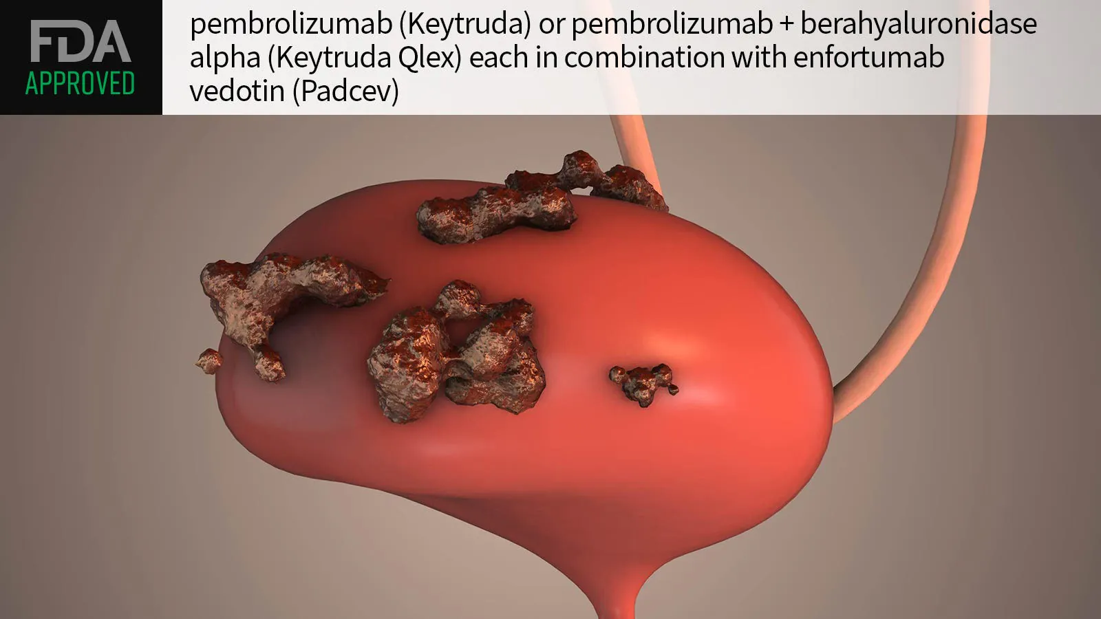 FDA expands chemo-free bladder cancer combo approval to all MIBC patients