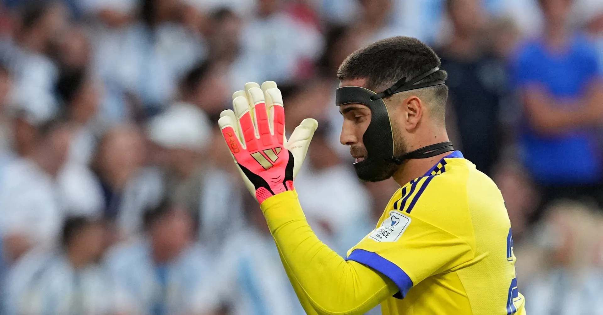 Soccer's hidden hazard: Why nasal fractures are more dangerous than they look