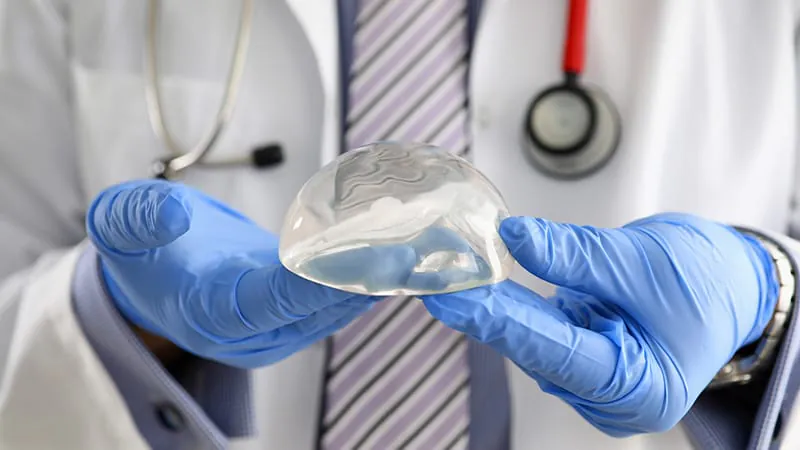 The 10-year breast implant "expiration date" is a myth, experts say