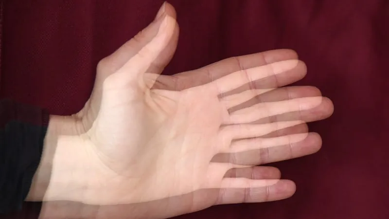 Heart and brain vascular disease significantly raise Parkinson's risk in women
