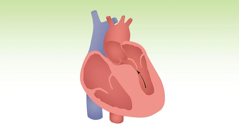 UK fast-tracks second heart drug for obstructive HCM, opening access for thousands