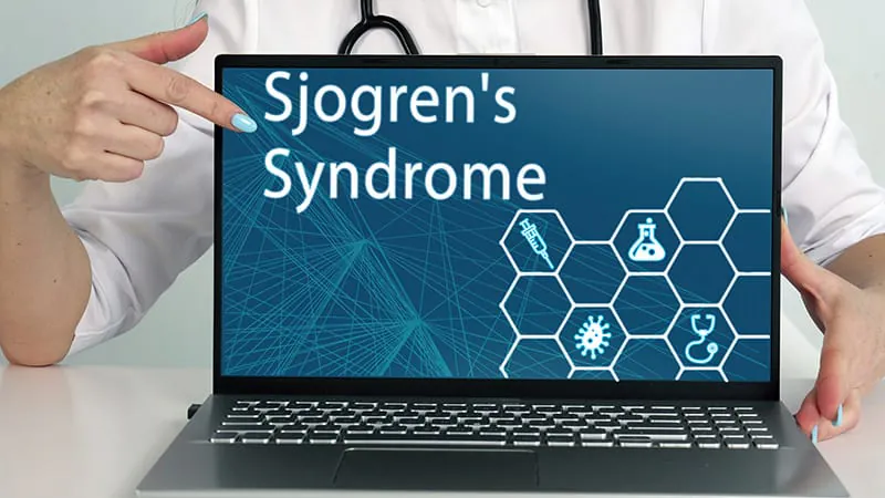 Sjögren's disease raises infection risk across bacterial, fungal, and viral categories