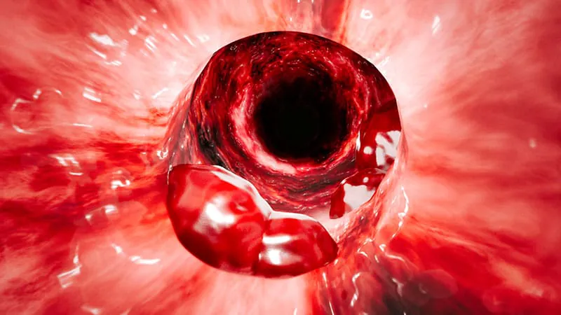 Don't let small size fool you: tiny colorectal lesions can still go deep