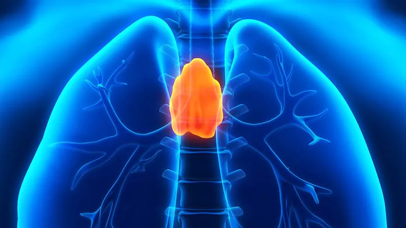 Thymectomy clears a decade-long safety check — with one key caveat