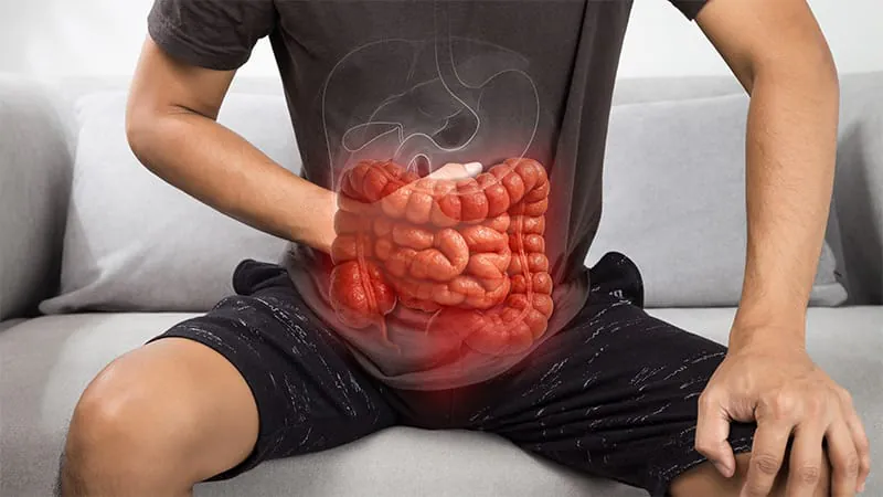 Rome V criteria reshape how we diagnose and treat chronic digestive disorders