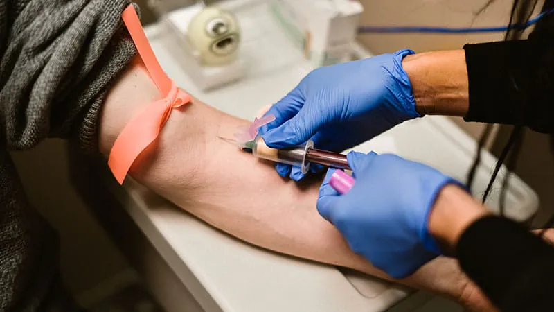 Opt-out hepatitis C screening in the ER is a game-changer for homeless patients