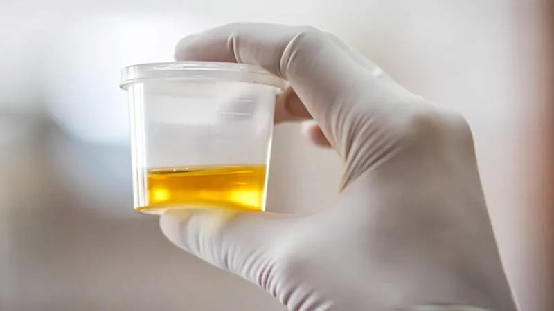 Rethink the go-to UTI antibiotic for postmenopausal women