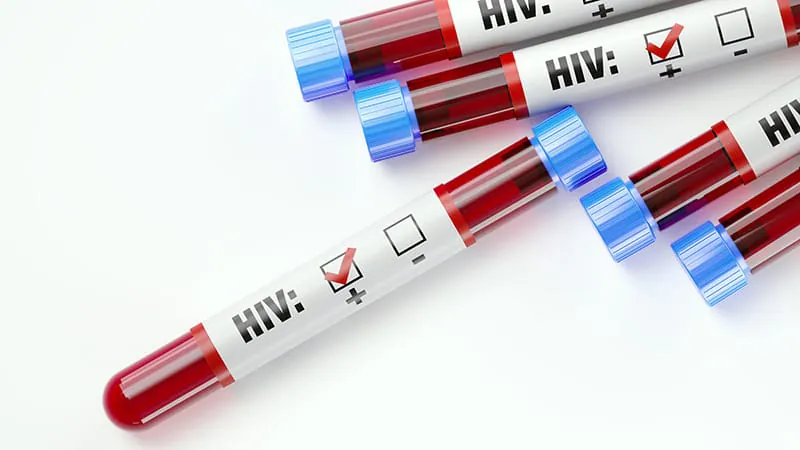 HIV care is a revolving door — and it's more common than we thought