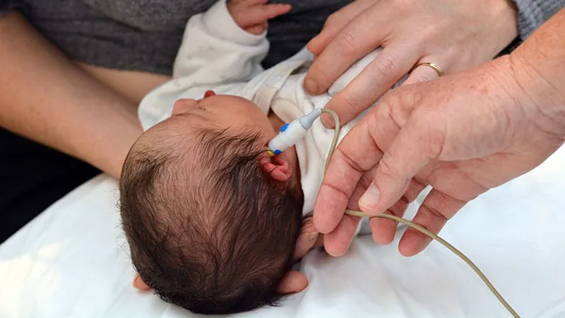 Failed newborn hearing screening in preemies linked to lower language and cognitive scores at age 2