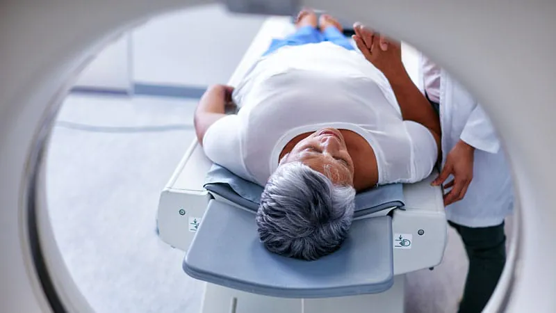 Your kidneys may be quietly affecting your brain's blood vessels