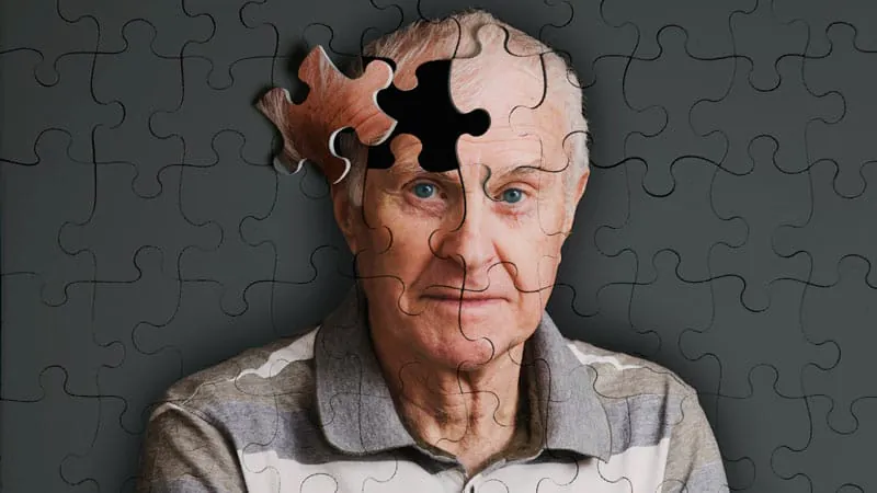 Most atypical Alzheimer's patients locked out of anti-amyloid treatments by flawed screening criteria