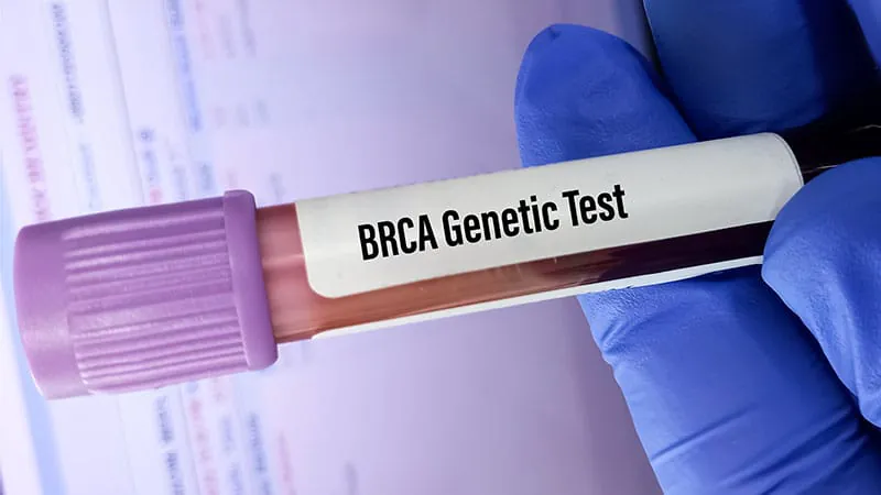 Inconclusive BRCA test results still signal elevated breast cancer risk