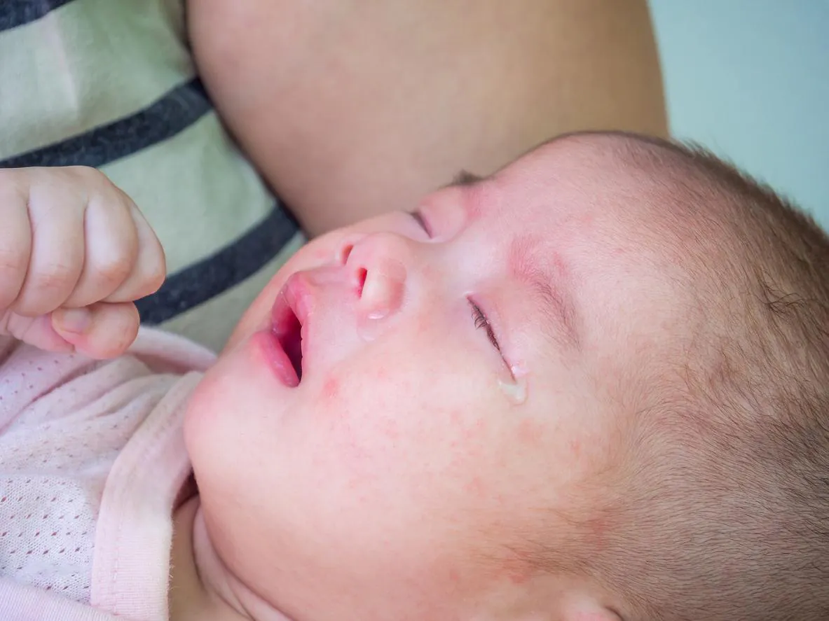 RSV antibody nirsevimab cuts antibiotic use in infants, study finds