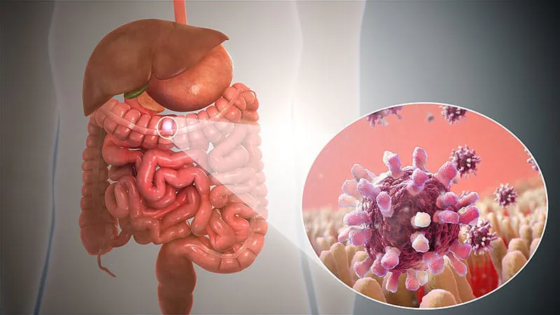 GI PCR outperforms stool culture for hospitalized gastroenteritis patients