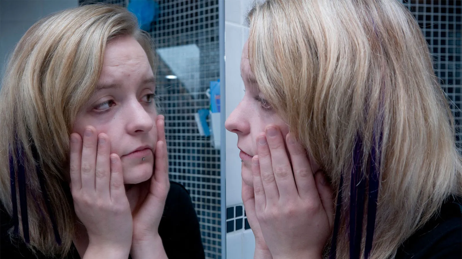 Is "ferritin face" a real thing? Hematologists say the signs are worth taking seriously