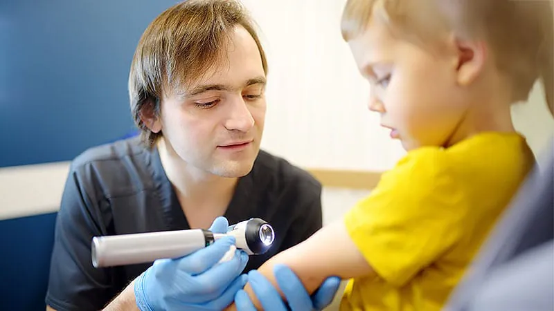 Rare skin disorder linked to dramatically higher rates of allergic disease
