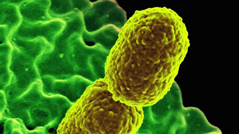 Antibiotic resistance doesn't always mean worse outcomes — here's what a large study found