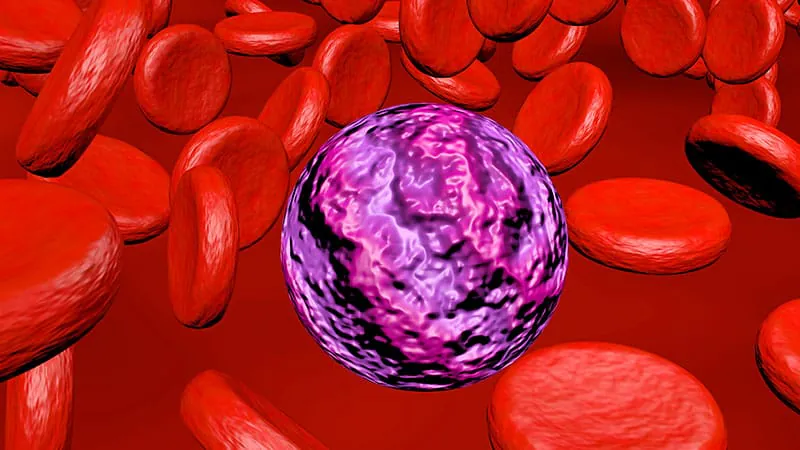 Treatment choice makes a big difference in NPM1-mutated AML survival
