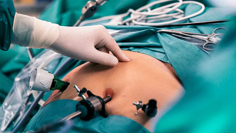 Bariatric surgery can make patients get drunk twice as fast — here's what to tell them