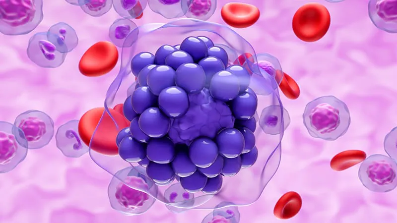 New regimens outperform standard chemo in hard-to-treat lymphoma