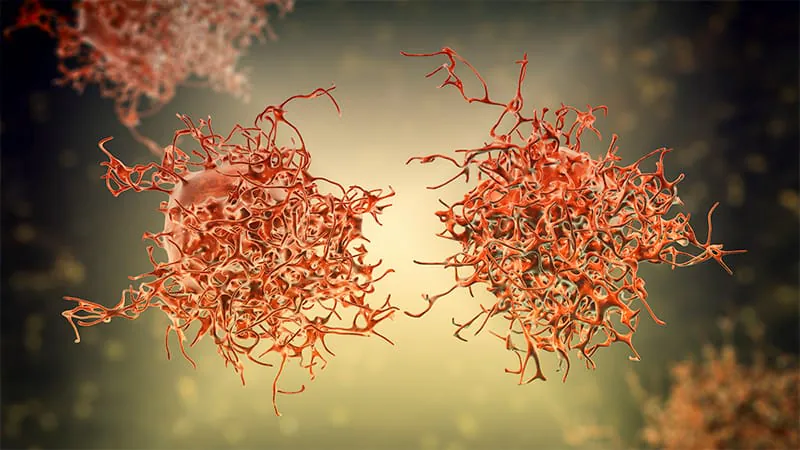 Transgender individuals favor HPV self-swabs for cervical cancer screening