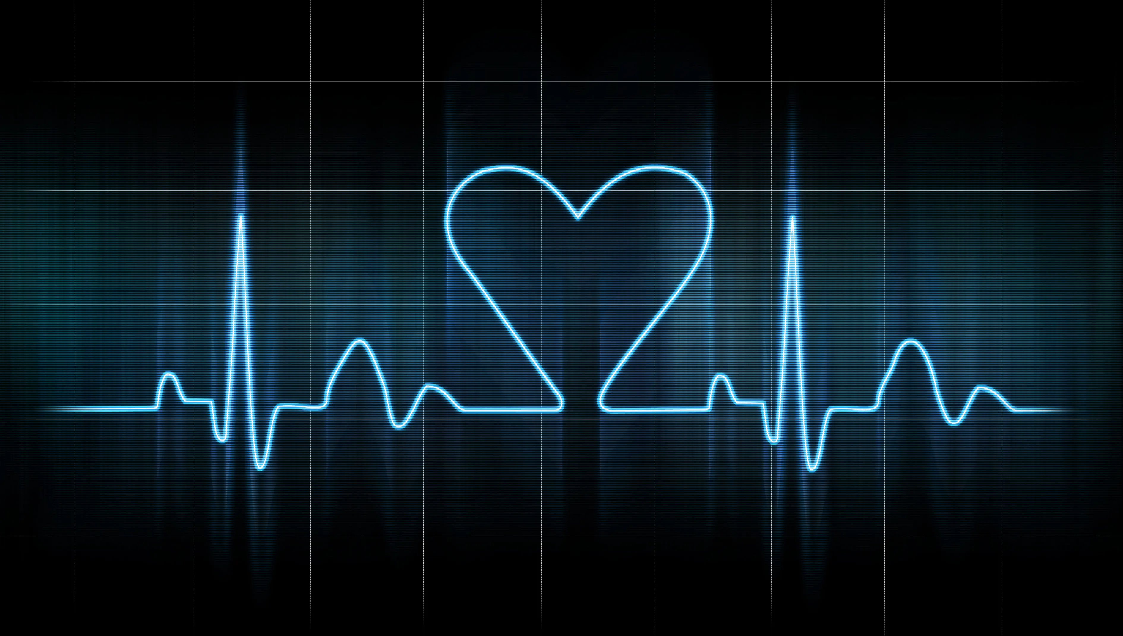 AHA/ACC overhaul atrial fibrillation care standards with sweeping new measures