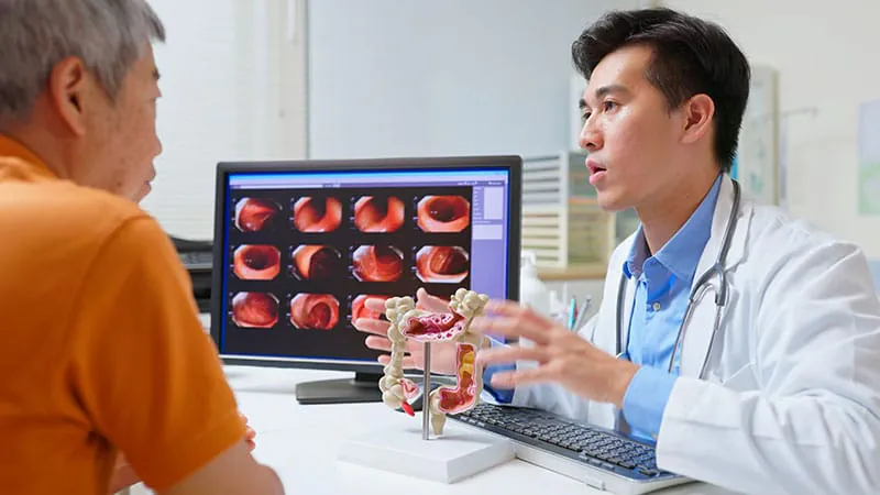 Quebec holds the line at 50 for colorectal cancer screening — despite rising cases in younger adults