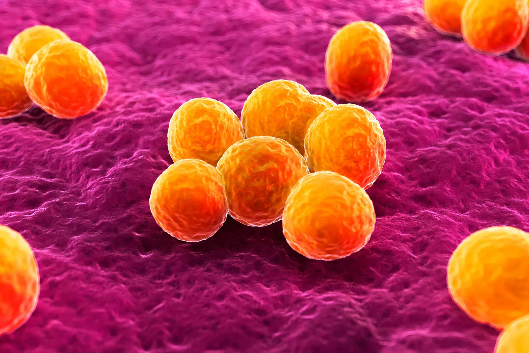 Cefazolin is just as effective as penicillins for staph bloodstream infections — and easier on the kidneys