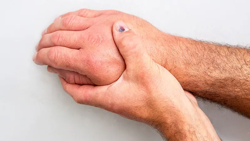 ZEUS trial flops, but experts say inflammation still matters in heart disease