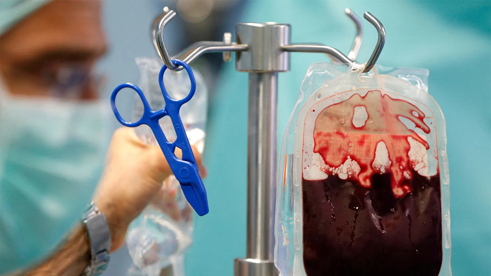 Could blood transfusions spread Alzheimer's-linked brain proteins? Scientists want answers