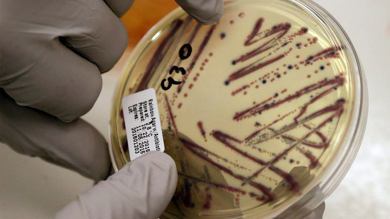 Alfalfa sprouts spark multi-pathogen food poisoning outbreak across 15 states