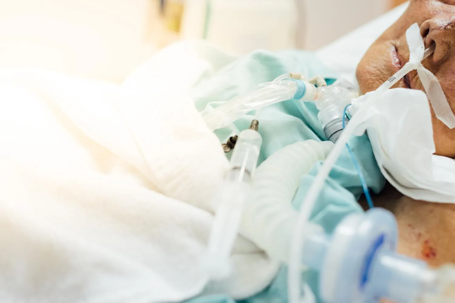 Drug-resistant hospital infections are killing far more patients in Asia than we thought
